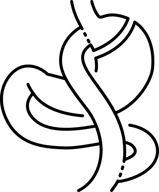 Gastric Bypass Surgery